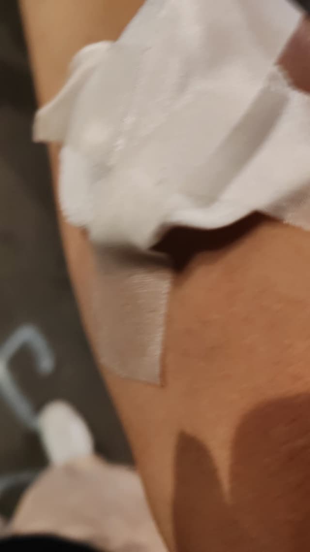 Direktno ispaljivanje suzavca na građanina na Tošinom bunaru 16.08.2025